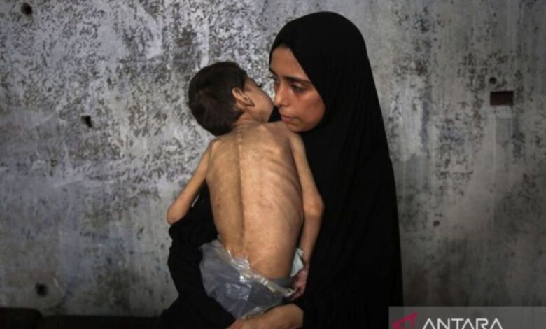 Daerah Wilayah Gaza dilanda krisis kelaparan akut, 271 tewas termasuk 112 anak